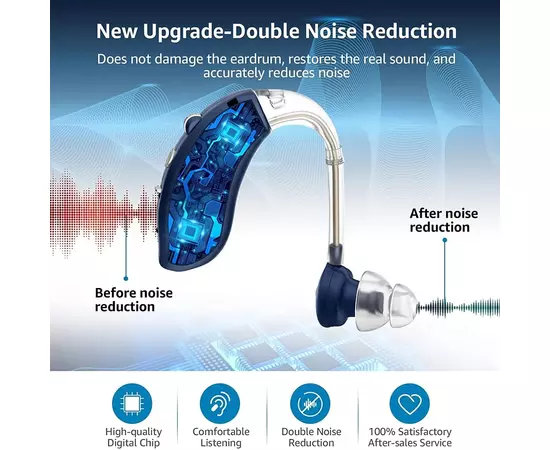 Aparelho de audição (surdez)