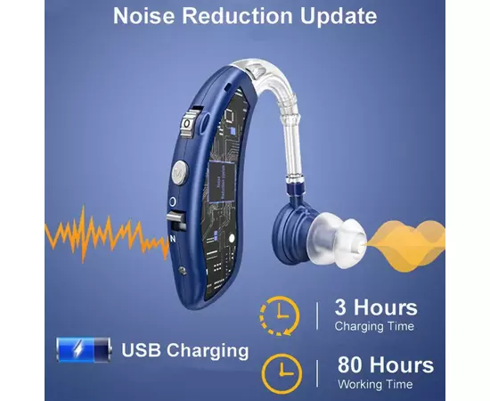 Aparelho de audição (surdez)