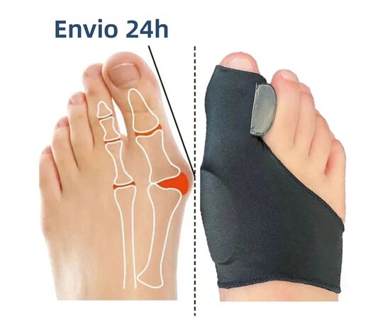 Par de correctores de ajoanetes